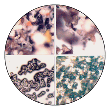 Ferrography Oil Analysis Test for Equipment Wear Detection – Liasotech Testing Lab